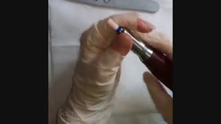 قسمت چهارم : ترمیم