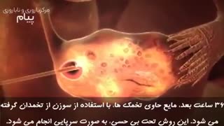 نحوه انجام آی وی اف