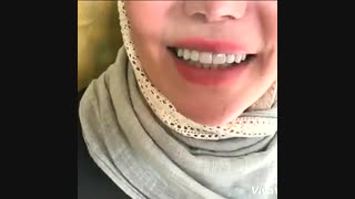 فیلم اصلاح طرح لبخند