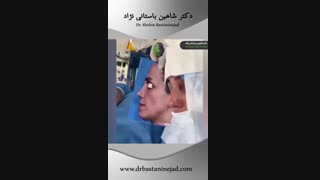 نمونه کارهای جراحی بینی ترمیمی | دکتر شاهین باستانی نژاد جراح بینی