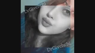 نمونه جراحی بینی دکتر گیوه چی