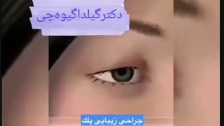 جراحی زیبایی پلک