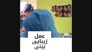 جراحی زیبایی بینی توسط دکتر گیوه چی