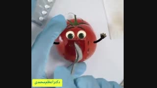 ویدیویی شمامتیک از زایمان سزارین