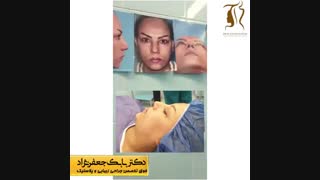 فیلم جراحی زیبایی بینی