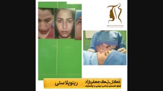 فیلم نمونه جراحی بینی