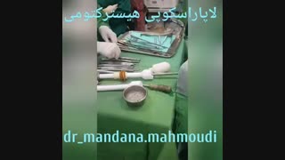 عمل جراحی لاپاراسکوپی هیسترکتومی