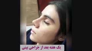 فیلم جراحی بینی