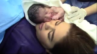 جراحی زایمان سزارین