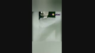 فیلم واقعی از جراحی دیسک کمر با لیزر