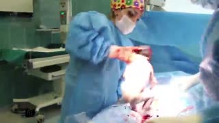 عمل زایمان سزارین