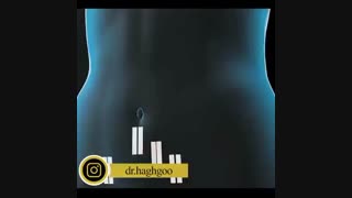 جراحی در دوران کرونا