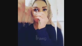 ترمیم ابرو با پروتز ابرو مصنوعی  چسبی | ترمیم ریزش ابرو