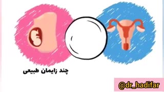 پرینورافی چیست؟