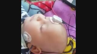 شنوایی سنجی نوزاد - سمعک برتر 02122909216