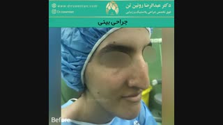 جراحی بینی | فوق تخصص جراحی پلاستیک | دکتر عبدالرضا روئین تن