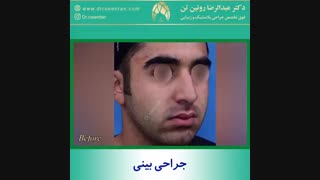 جراحی بینی | فوق تخصص جراحی پلاستیک | دکتر عبدالرضا روئین تن