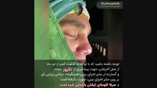 جراحی بینی ترمیمی و بازسازی کلوملا | دکتر باستانی نژاد جراح بینی تهران