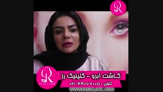 فیلم کاشت ابرو | کلینیک رز | 02144067005 | شماره 196