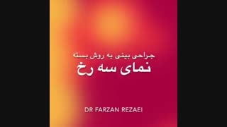 نمونه جراحی بینی با انحراف زیاد