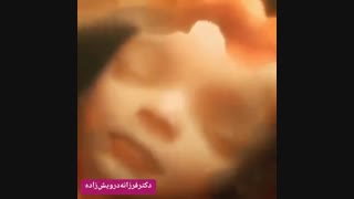 حرکات جنین در رحم مادر