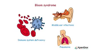 سندروم بلووم - Bloom Syndrome