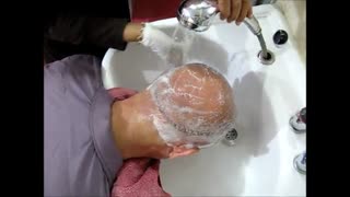 شستشوی سر بعد از کاشت مو