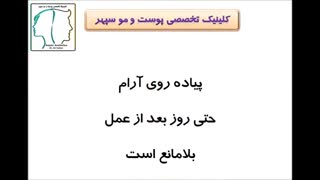 ورزش بعد از کاشت مو