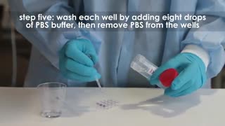 انواع آنزیم آزمایشگاهی را باید از کجا خرید ؟ (09357007743 فروش)