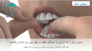 روش استفاده از نخ دندان برای سلامت دندان - زیبایی سنتر