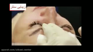 سابسیژن برای درمان جای جوش،اسکار،آبله،مرغان،پاکسازی پوست استفاده میشود بررسی لک صورت
