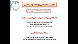 داروهای کاشت موی طبیعی