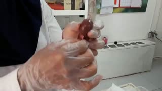 فیلم تشریخ کلیه