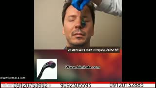 درمارولر اصل کیم کالا | 09120750932 | درمارولر چیست | درمان ریزش مو | بهترین دستگاه نیدلینگ | رفع جوش های صورت