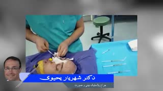 جراحی بینی و پی آر پی