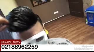 ترمیم موالگانت /02188962259/پروتز مو