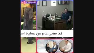 عملیه استبدال مفصل الحوض