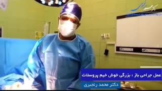 فیلم عمل جراحی پروستات بزرگ خوش خیم