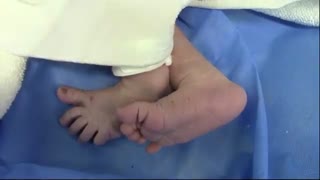 جراحی زایمان سزارین