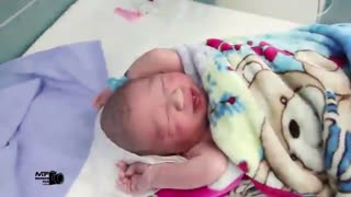 جراحی زایمان سزارین