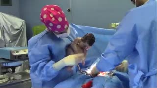 عمل جراحی سزارین