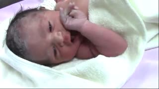 جراحی سزارین در تهران