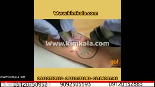 دستگاه لیزر تتو کیوسوییچ | 09120132833 | پاک کردن تتو | روش های پاک کردن تتو | لیزر کردن تتو ابرو | پاک کردن تتو با لیزر