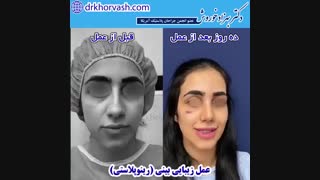 فیلم عمل بینی