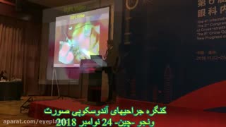 آموزش جراحی آندوسکوپی لیفت ابرو و پیشانی توسط پروفسور کشکولی در چین