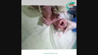 فیلم عمل زایمان از شروع تا پایان