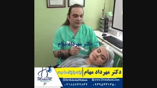 پلاسما جت و لیفت