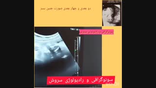 فیلم چهار بعدی و دو بعدی صورت جنین