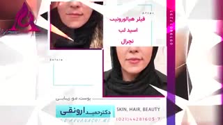 نمونه کار دکتر حمید ارونقی ترمیم دندان