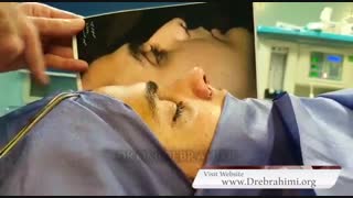 جراحی بینی گوشتی کج توسط دکتر امید ابراهیمی بهترین جراح بینی